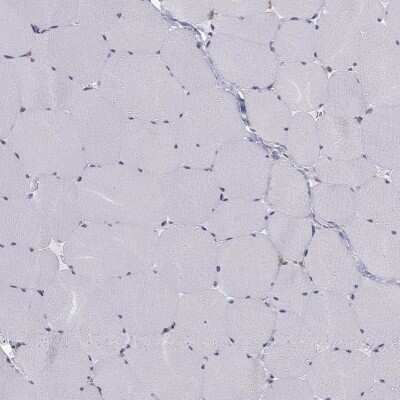 Immunohistochemistry-Paraffin: CCDC40 Antibody [NBP1-82162]