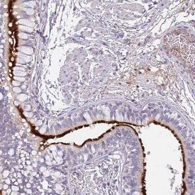 Immunohistochemistry-Paraffin: CCDC42B Antibody [NBP2-14643]