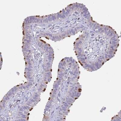 Immunohistochemistry-Paraffin: CCDC42B Antibody [NBP2-14643]