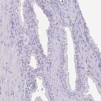 Immunohistochemistry-Paraffin: CCDC42B Antibody [NBP2-14643]