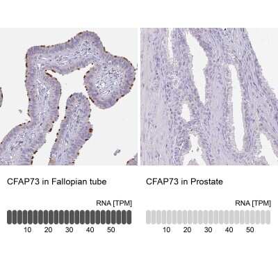 Immunohistochemistry-Paraffin: CCDC42B Antibody [NBP2-14643]