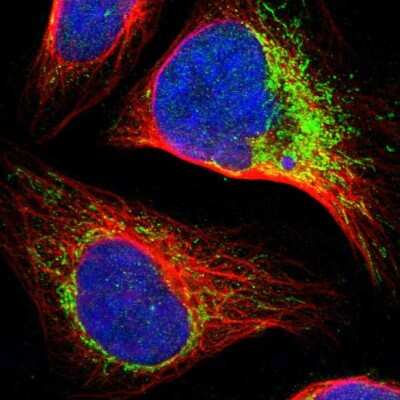 Immunocytochemistry/ Immunofluorescence: CCDC44 Antibody [NBP1-88160]