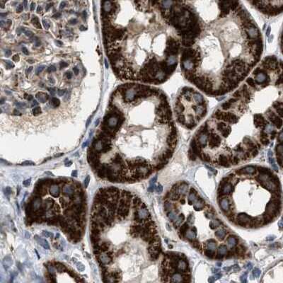 Immunohistochemistry-Paraffin: CCDC44 Antibody [NBP1-88160]