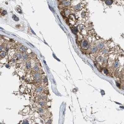 Immunohistochemistry-Paraffin: CCDC44 Antibody [NBP1-88160]