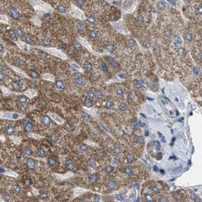 Immunohistochemistry-Paraffin: CCDC44 Antibody [NBP1-88160]