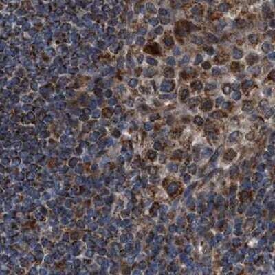 Immunohistochemistry-Paraffin: CCDC44 Antibody [NBP1-88160]