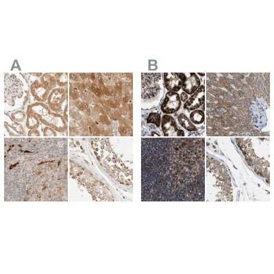 Immunohistochemistry-Paraffin: CCDC44 Antibody [NBP1-88161]
