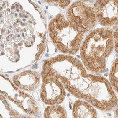 Immunohistochemistry-Paraffin: CCDC44 Antibody [NBP1-88161]