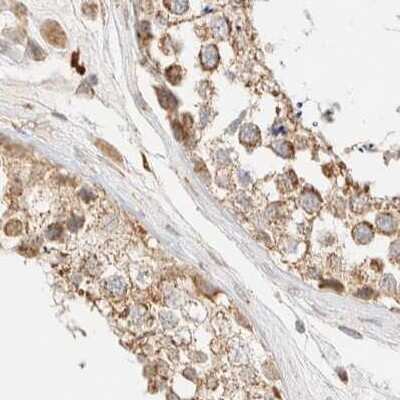 Immunohistochemistry-Paraffin: CCDC44 Antibody [NBP1-88161]