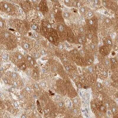 Immunohistochemistry-Paraffin: CCDC44 Antibody [NBP1-88161]