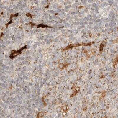 Immunohistochemistry-Paraffin: CCDC44 Antibody [NBP1-88161]
