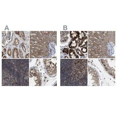 Immunohistochemistry-Paraffin: CCDC44 Antibody [NBP1-88162]
