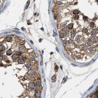 Immunohistochemistry-Paraffin: CCDC44 Antibody [NBP1-88162]