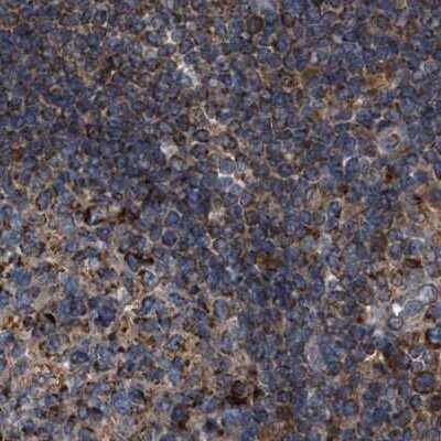Immunohistochemistry-Paraffin: CCDC44 Antibody [NBP1-88162]