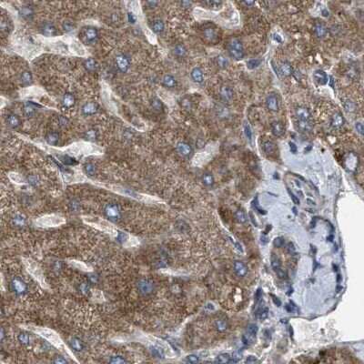 Immunohistochemistry-Paraffin: CCDC44 Antibody [NBP1-88162]