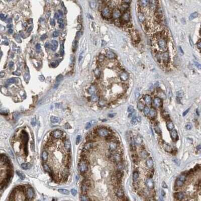 Immunohistochemistry-Paraffin: CCDC44 Antibody [NBP1-88162]