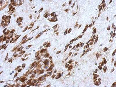 Immunohistochemistry-Paraffin: CCDC44 Antibody [NBP2-15749]