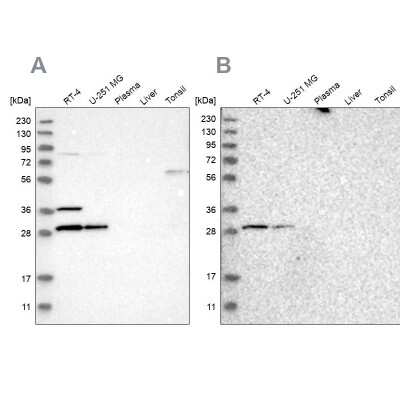 Western Blot: CCDC44 Antibody [NBP1-88160]