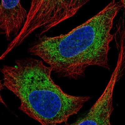 Immunocytochemistry/ Immunofluorescence: CCDC47 Antibody [NBP2-56445]