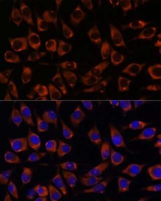 Immunocytochemistry/ Immunofluorescence: CCDC47 Antibody - Azide and BSA Free [NBP2-92269]
