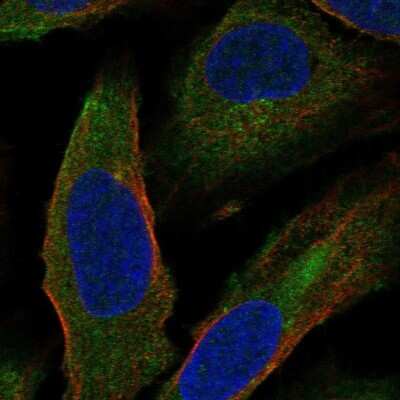 Immunocytochemistry/ Immunofluorescence: CCDC5 Antibody [NBP1-88159]
