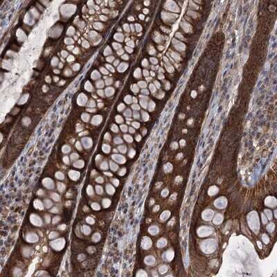 Immunohistochemistry-Paraffin: CCDC5 Antibody [NBP1-88158]