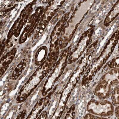 Immunohistochemistry: CCDC57 Antibody [NBP2-47521]
