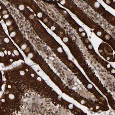 Immunohistochemistry: CCDC57 Antibody [NBP2-48566]