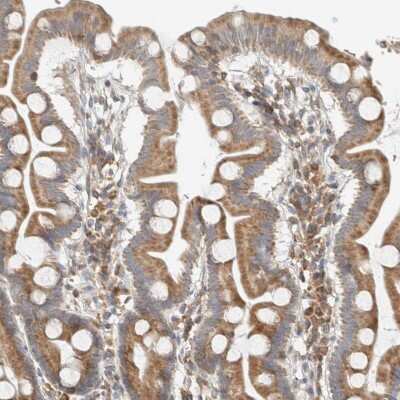 Immunohistochemistry-Paraffin: CCDC57 Antibody [NBP2-47522]