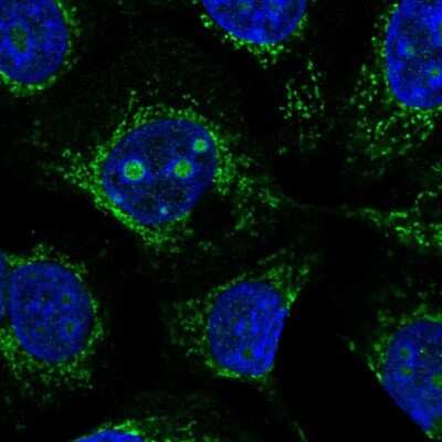 Immunocytochemistry/ Immunofluorescence: CCDC58 Antibody [NBP2-55464]
