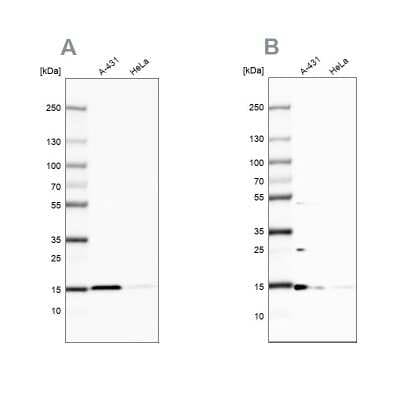 Western Blot: CCDC58 Antibody [NBP2-14452]