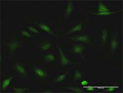 Immunocytochemistry/ Immunofluorescence: CCDC6 Antibody [H00008030-D01P]