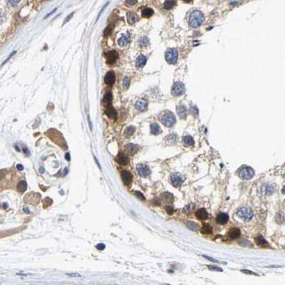 Immunohistochemistry-Paraffin: CCDC6 Antibody [NBP1-85351]