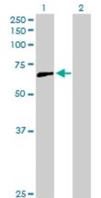 Western Blot: CCDC6 Antibody [H00008030-D01P]
