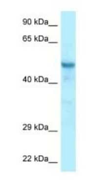 Western Blot: CCDC6 Antibody [NBP1-98370]