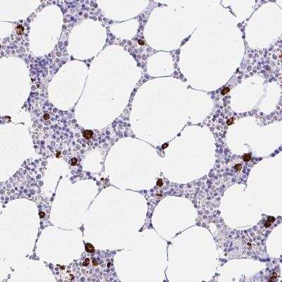 Immunohistochemistry-Paraffin: CCDC62 Antibody [NBP2-32398]