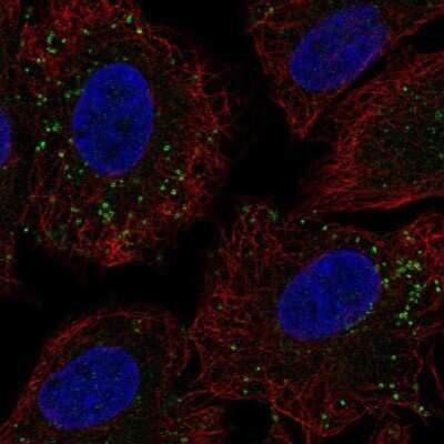 Immunocytochemistry/ Immunofluorescence: CCDC65 Antibody [NBP2-56860]