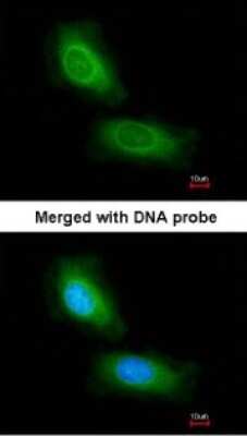 Immunocytochemistry/ Immunofluorescence: CCDC68 Antibody [NBP1-31622]