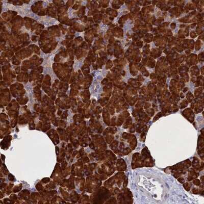 Immunohistochemistry: CCDC68 Antibody [NBP2-47519]