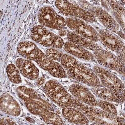 Immunohistochemistry-Paraffin: CCDC69 Antibody [NBP1-85139]