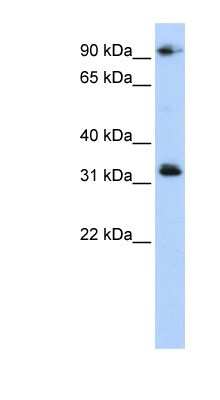 Western Blot: CCDC69 Antibody [NBP1-56589]