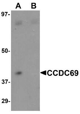 Western Blot: CCDC69 AntibodyBSA Free [NBP1-77145]