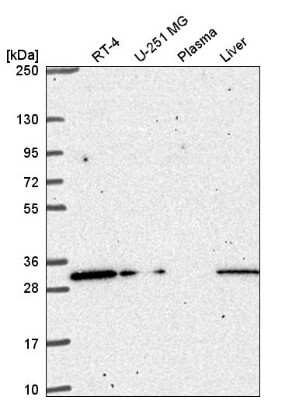 Western Blot: CCDC69 Antibody [NBP2-55589]