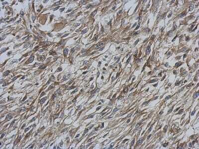 Immunohistochemistry-Paraffin: CCDC70 Antibody [NBP2-15754]