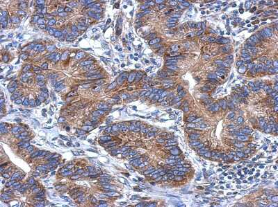 Immunohistochemistry-Paraffin: CCDC70 Antibody [NBP2-15754]