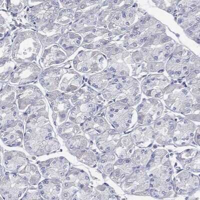 Immunohistochemistry-Paraffin: CCDC70 Antibody [NBP3-17100]