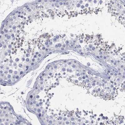 Immunohistochemistry-Paraffin: CCDC70 Antibody [NBP3-17100]