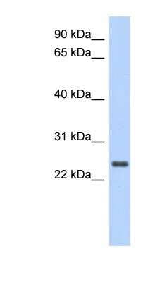 Western Blot: CCDC70 Antibody [NBP1-55305]