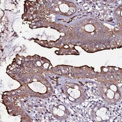 Immunohistochemistry-Paraffin: CCDC71 Antibody [NBP2-14600]