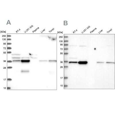 Western Blot: CCDC75 Antibody [NBP1-93801]